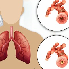 COPD (Chronic Obstructive Pulmonary Diease) (ETDF)