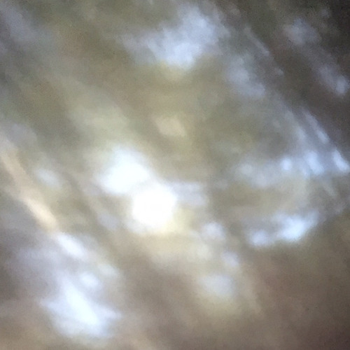 Sky RN - Ft. Jesse Samples
