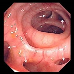 Organs 1.45x