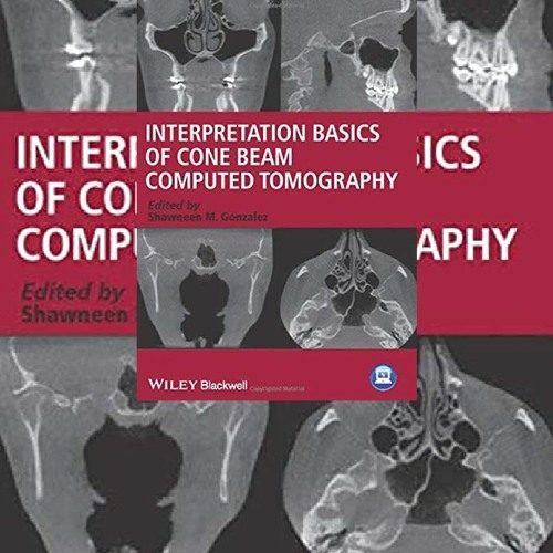 Stream PDF Download Interpretation Basics Of Cone Beam Computed ...