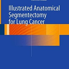 [VIEW] [EPUB KINDLE PDF EBOOK] Illustrated Anatomical Segmentectomy for Lung Cancer by  Hiroaki Nomo
