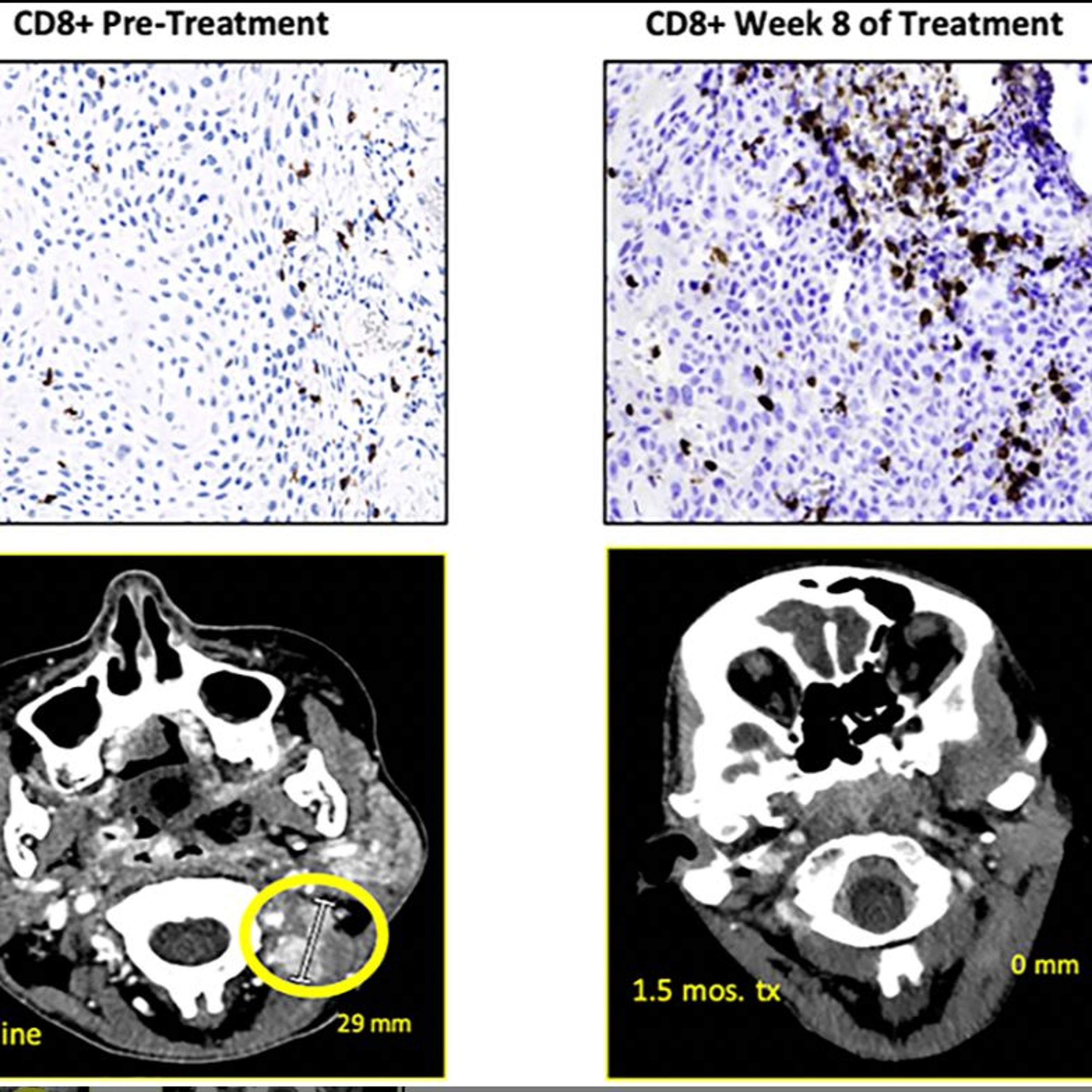 Oncotarget