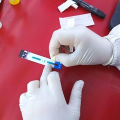 Darío Di Pratula-Día Mundial del VIH: hacete el test gratis y de forma confidencial