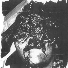 vomit