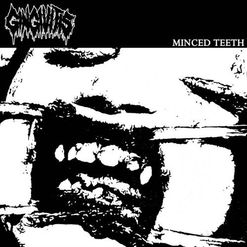 MINCED TEETH FULL EP - GINGIVITIS