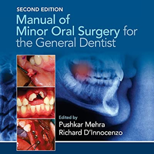 GET KINDLE 🖌️ Manual of Minor Oral Surgery for the General Dentist by  Pushkar Mehra