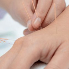 How Acupuncture Helps Fibromyalgia Patients