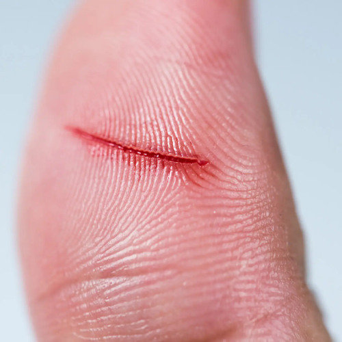 i hope u get a papercut