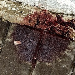 kikk shit w/ 5caskets (ksubi)