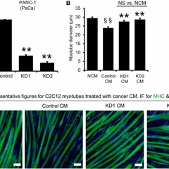 KIAA0930: A Cachexic Phenotype Inducer in Cancer Cells