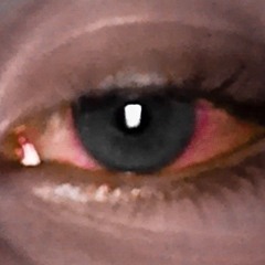 redeyes