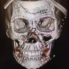 30 CLIP AKSTAKKINGX NICO101 LSBACKEND