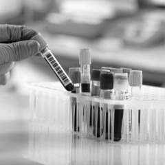 Return of the repressed