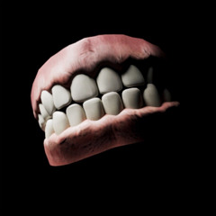 veneers.