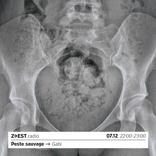 Peste sauvage avec Gabi - 07/ Soundcloud podcast image for