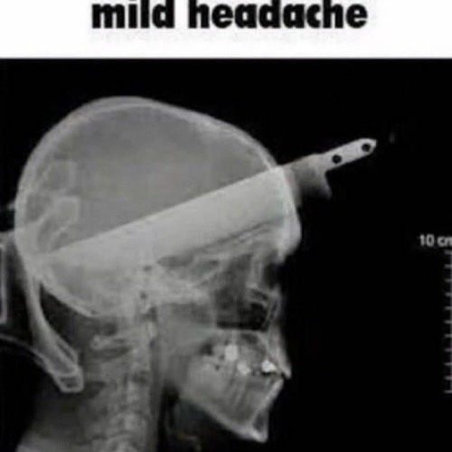 Bones but a metal pipe falls every noun