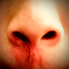 Bloody Nose