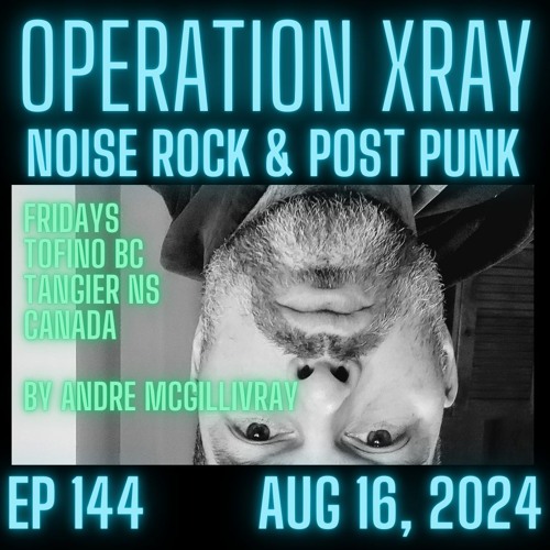 Operation XRAY - EP 144 - AUG 16, 2024