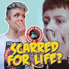 "Scarred for Life?" – In Orbit Every Wednesday