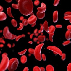 Accelerated Aging in Young People with Sickle Cell Disease