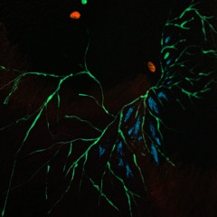 Symbiosonification with Ganoderma sessile.