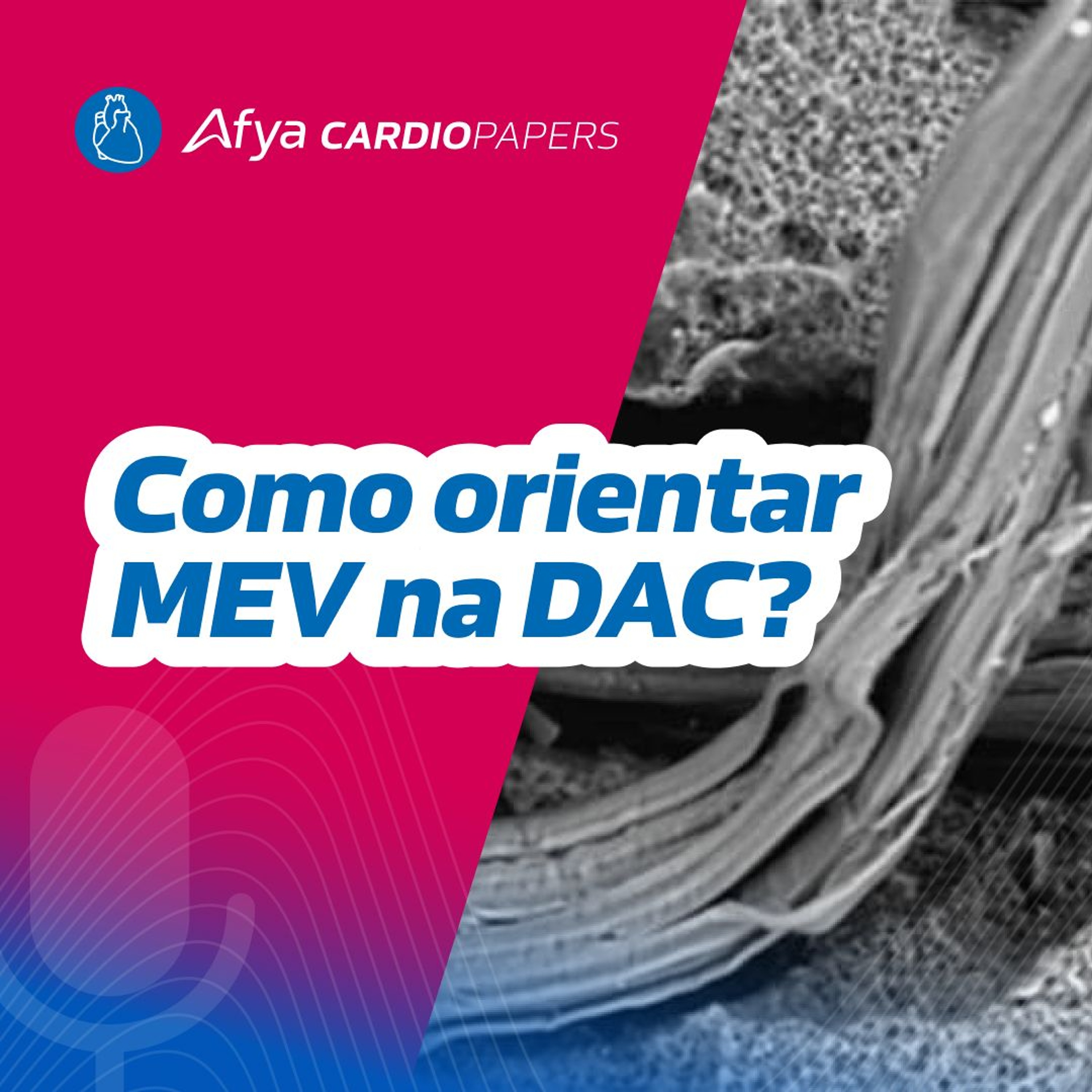 Mudança no estilo de vida para tratamento da DAC - Diretriz ESC 2024 episode artwork