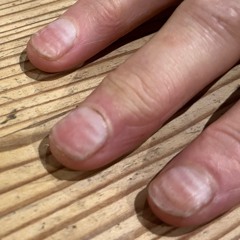 Trumpty Dumpty (Fingernail Tree Rings) 2025-10-26 19.14.23