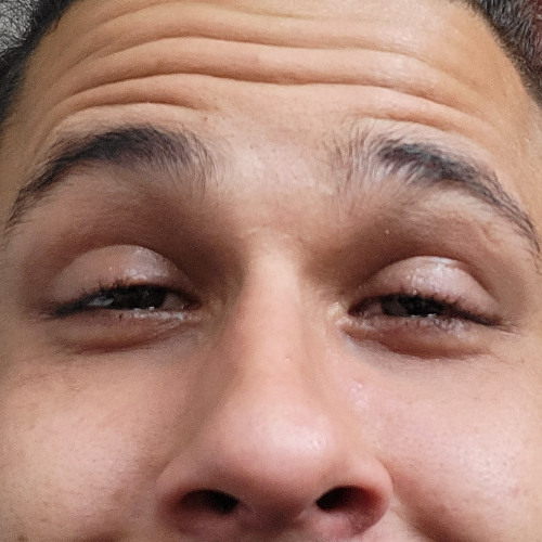 ins Auge gefritzt #3