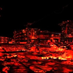 Hand Crushed By An Anvil