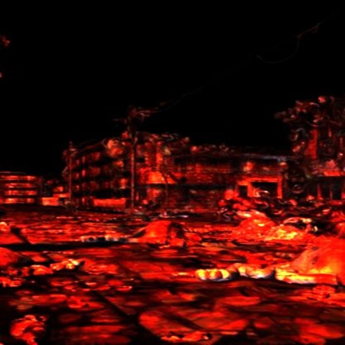 Hand Crushed By An Anvil