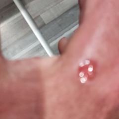 Yo Yo Composent Maxim