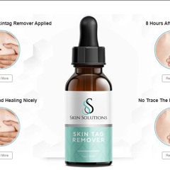 Speech Skin Solutions Skin Tag Remover