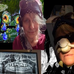 new sad song - tooth extraction antibiotic induced blues