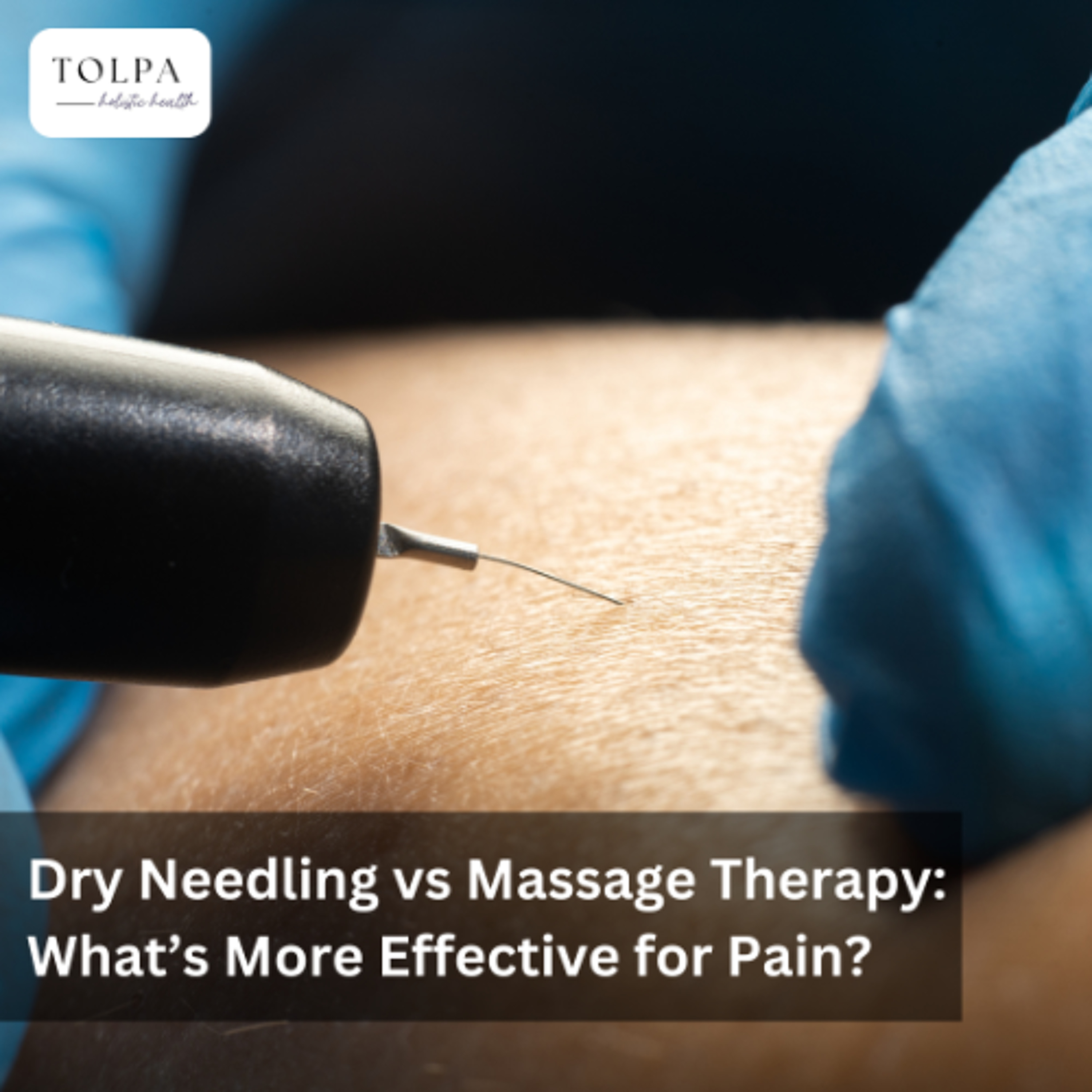 Dry Needling vs Massage Therapy: What’s More Effective for Pain?