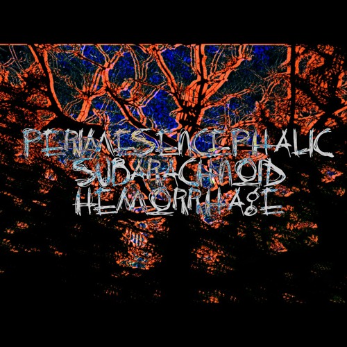 PERIMESENCEPHALIC SUBARACHNOID HEMORRHAGE