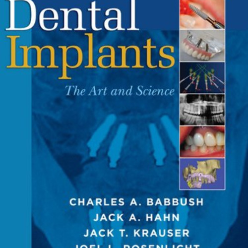 GET PDF 🖌️ Dental Implants: The Art and Science by  Charles A. Babbush,Jack A. Hahn,