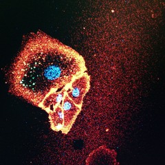regeneration.