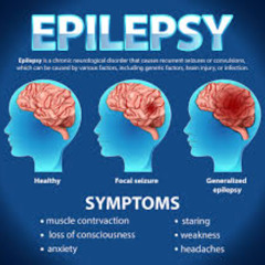 TB Respect - epilepsy awareness