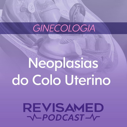 Stream episode Neoplasias do colo uterino by revisamed podcast podcast |  Listen online for free on SoundCloud