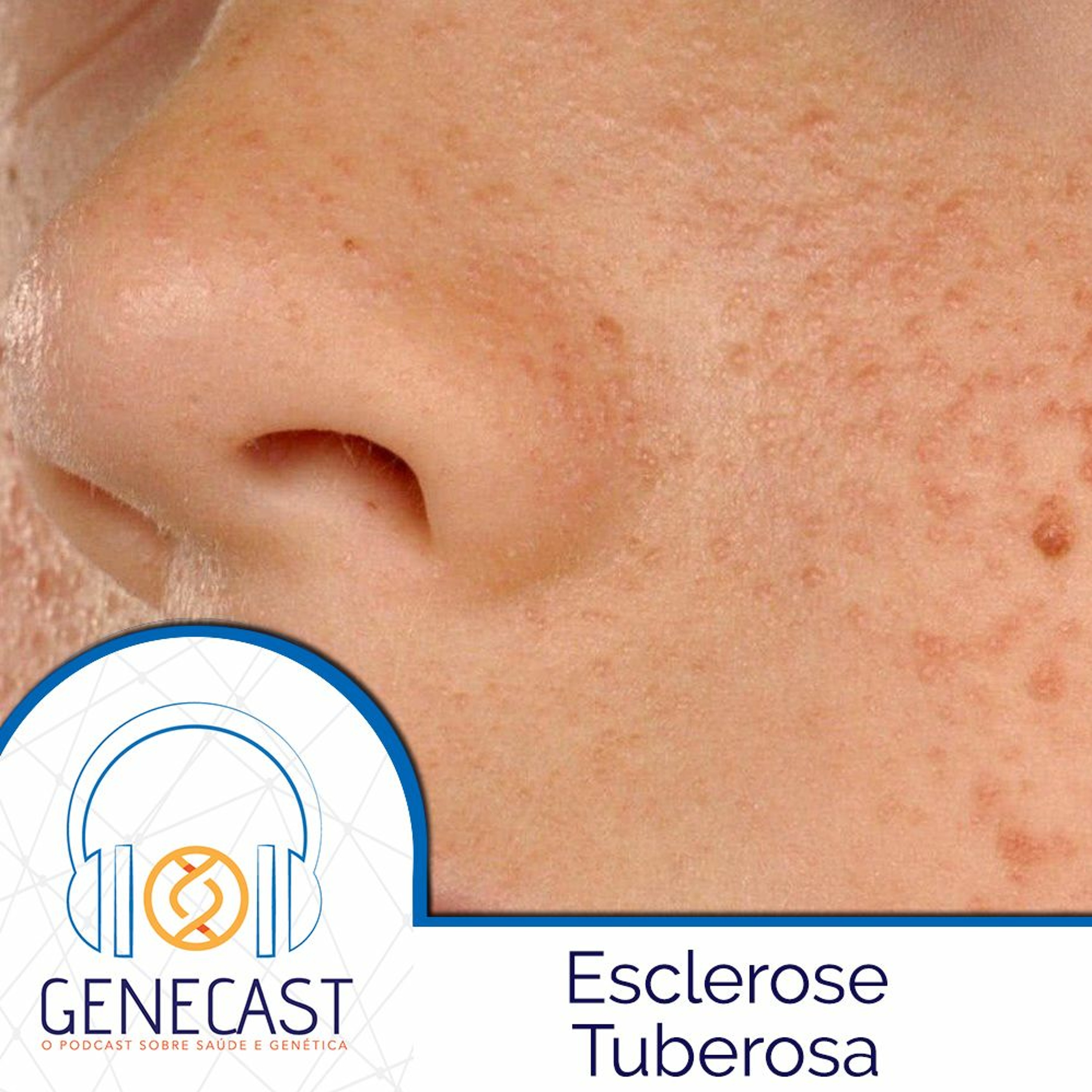 Genecast