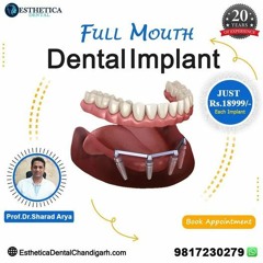 Affordable Dental Implant Cost In Mohali Restore Y
