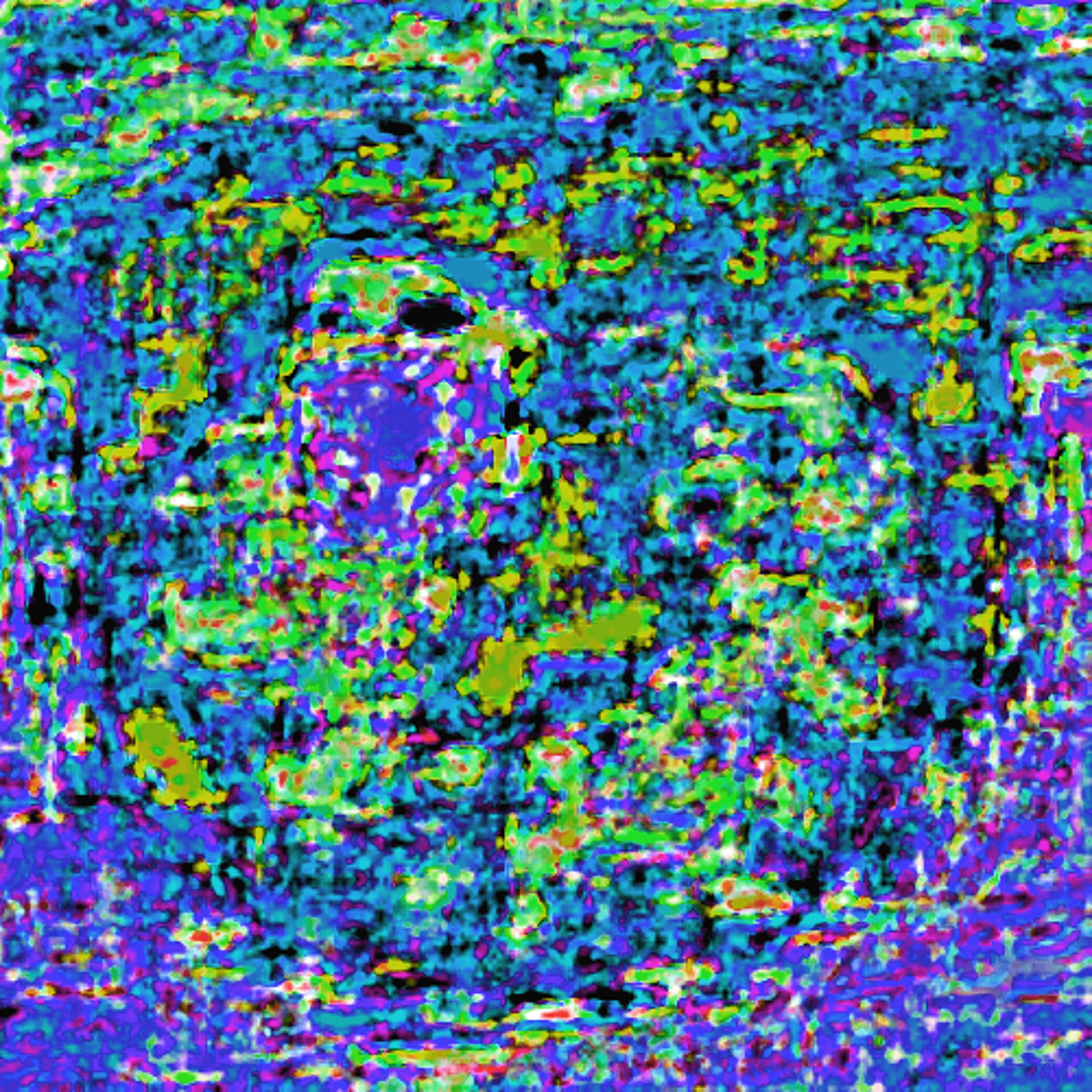 Zynduro 01 episode artwork