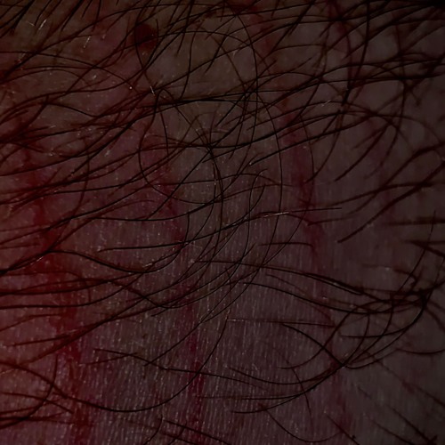 Scars Are Important For U To See That I Still Love U.