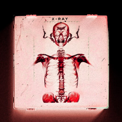 X-RAY (Rage Edit)