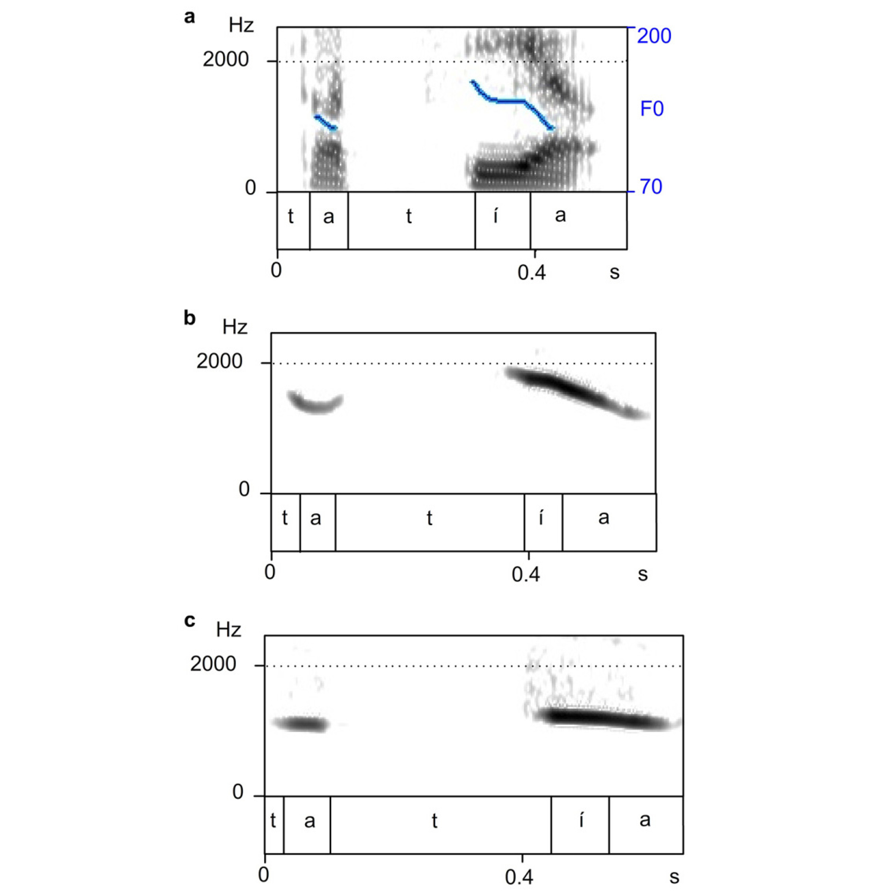 Environmental and Linguistic Typology of Whistled Languages: Audio S9a episode artwork