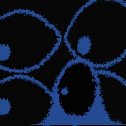 Solitude - Block Tales (remix)