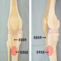 broken knees