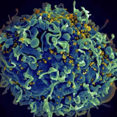 What’s Right: Melbourne’s mRNA Breakthrough Offers New Hope Against HIV
