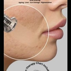 Ebook (Read) Flawless Skin: Skin Resurfacing Guide for Acne Scarring-Ageing Lines-Sun Damage-Pig