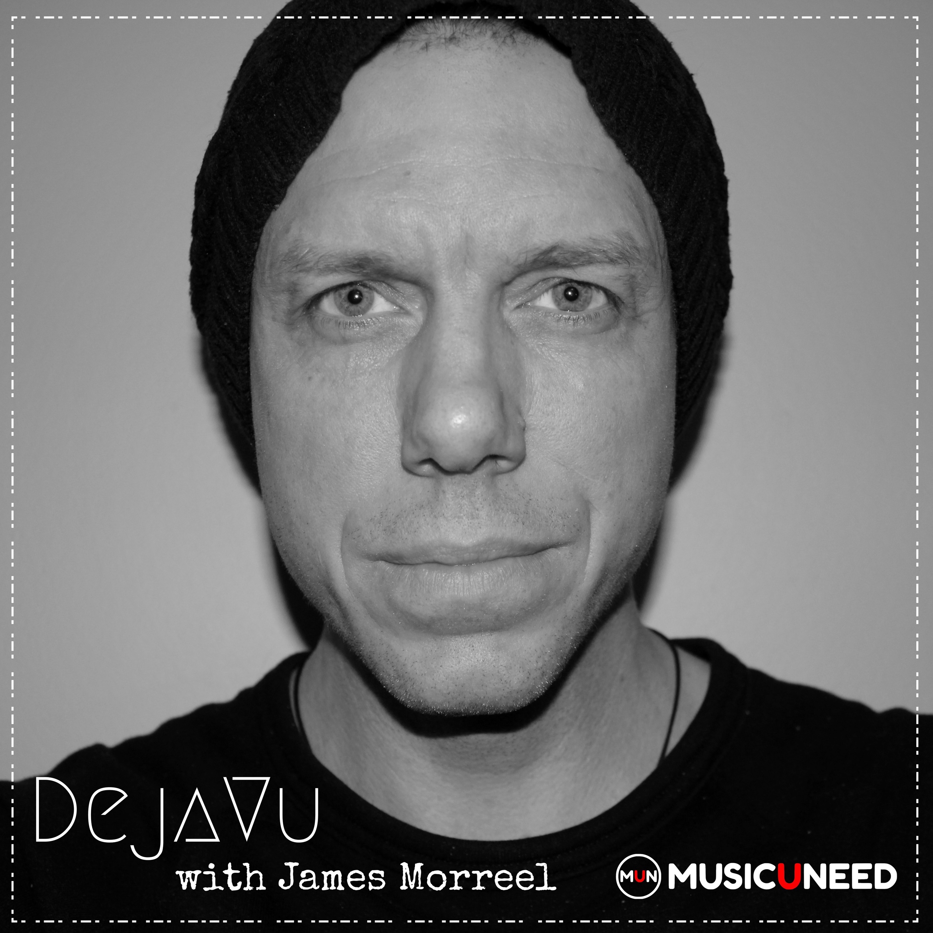 MUSICUNEED
